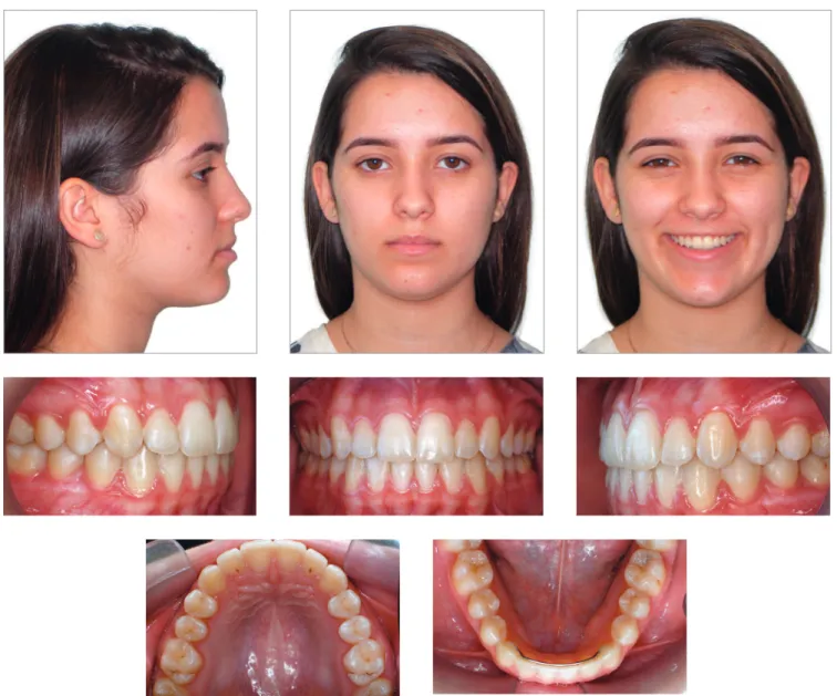 Figure 15 - Final facial and intraoral photographs.