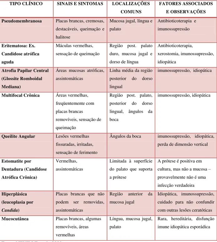 Tabela 1- Formas Clínicas de Candidose Bucal 