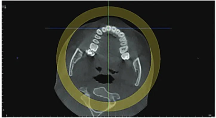 Figure 3 - Coronal slice.