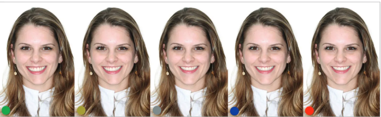 Figure 1 - Original smile (green label), with 5.88° of inclination and 5.54 mm of mandibular deviation, and their corrections (1.47° and 1.385 mm in each photo).
