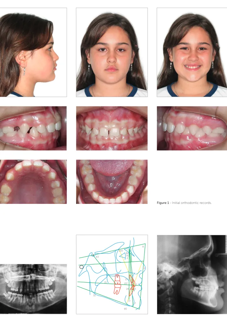 Figure 1 - Initial orthodontic records.