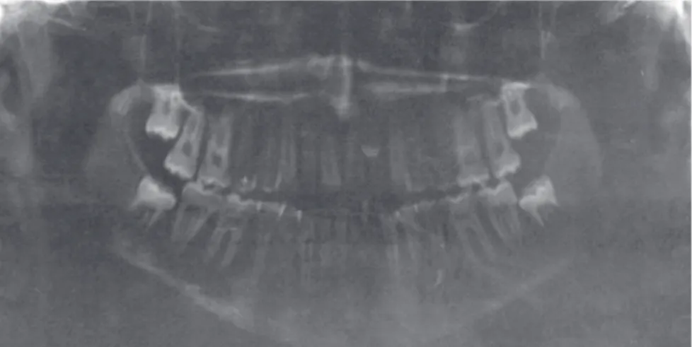 Figure 3 - Initial panoramic radiograph.
