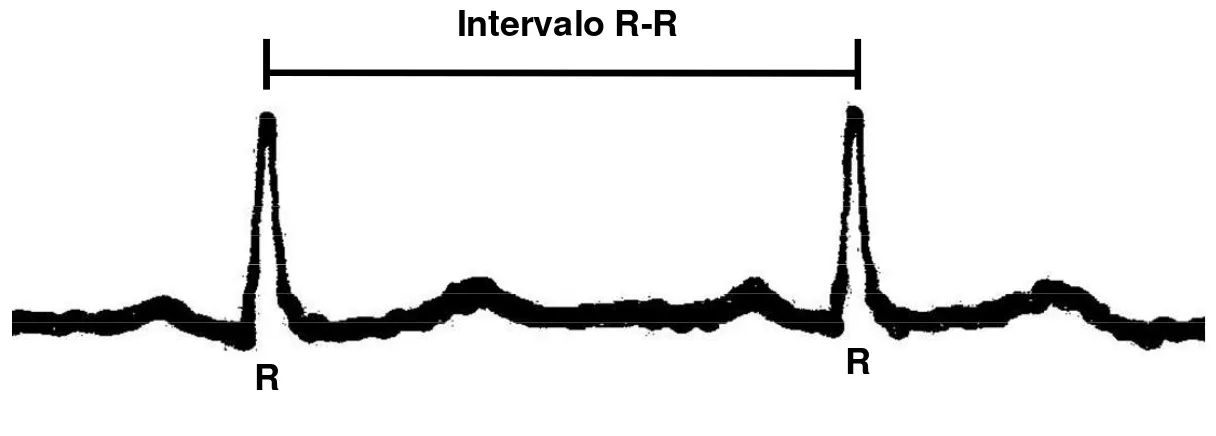 Figura 2.2: Intervalo RR 