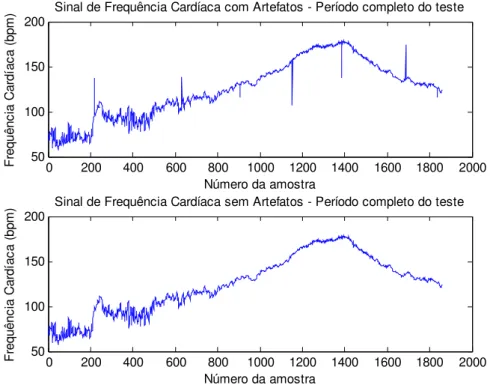 Figura 4.1 – Filtragem do sinal de frequência cardíaca de um dos voluntários do estudo