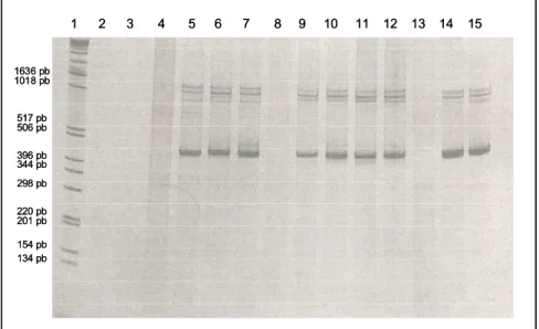 Figura 7:  Amplificação do gene PvAMA-1 por  Nested  PCR em amostras 