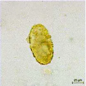 Figura 4.14 – Ovo fértil de  Ascaris lumbricoides Figura 4.15 – Ovo infértil de  Ascaris  lumbricoides