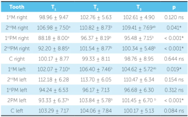 Table 3 shows means and standard deviation values  of maxillary teeth tipping, expressed in degrees, at T 1 ,  T 2  and T 3 , and the results of ANOVA and Tukey’s test