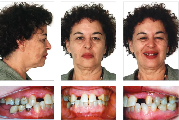 Figure 6 - Post-treatment facial and intraoral photographs.