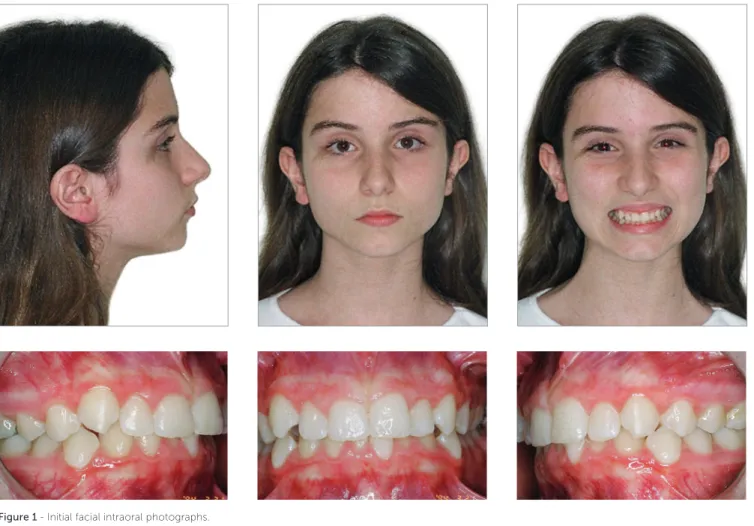 Figure 1 - Initial facial intraoral photographs.