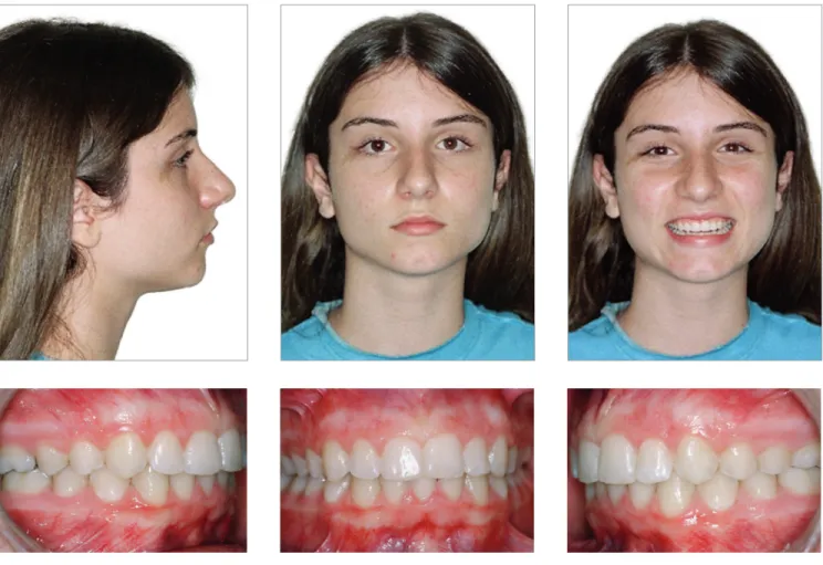 Figure 5 - Final facial intraoral photographs.