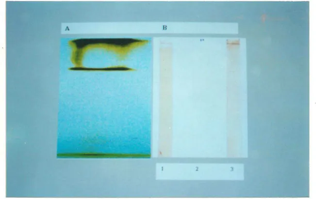 Figura 10.  Eletroforese e “western blotting” do antígeno PI em condições nativas. Em  (A): gel nativo de amostra de antígeno PI