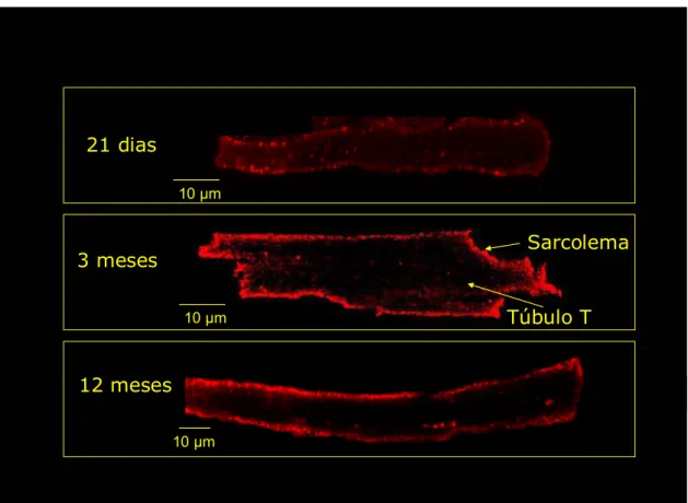 Figura 4- Imunolocalização do receptor Mas no miócito ventricular isolado de  ratos Wistar de 21 dias, 3 meses e 12 meses