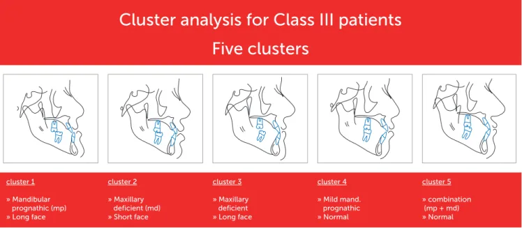 Figure 1 - A cluster analysis of 309 individuals with Class III malocclusion revealed that five subtypes were predominant.  A representative cephalometric image  accompanies each subtype.
