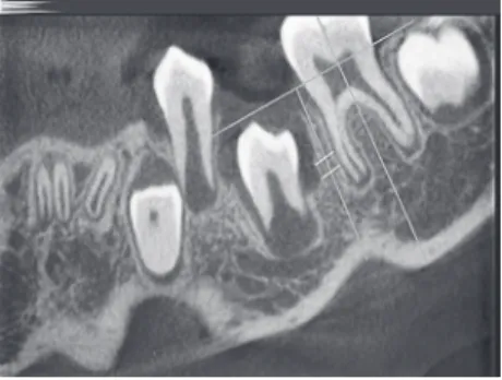 Figure 1 - Sagittal, coronal and axial slices. Figure 2 - Vertical and horizontal reference plane.