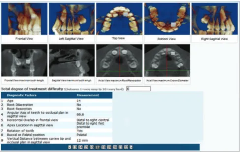 Figure 4 - Web-base questionnaire for 50 im- im-pacted canines that each expert orthodontist  evaluated for subjective degree of difficulty