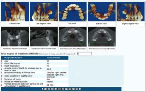 Figure 4 - Web-base questionnaire for 50 im- im-pacted canines that each expert orthodontist  evaluated for subjective degree of difficulty