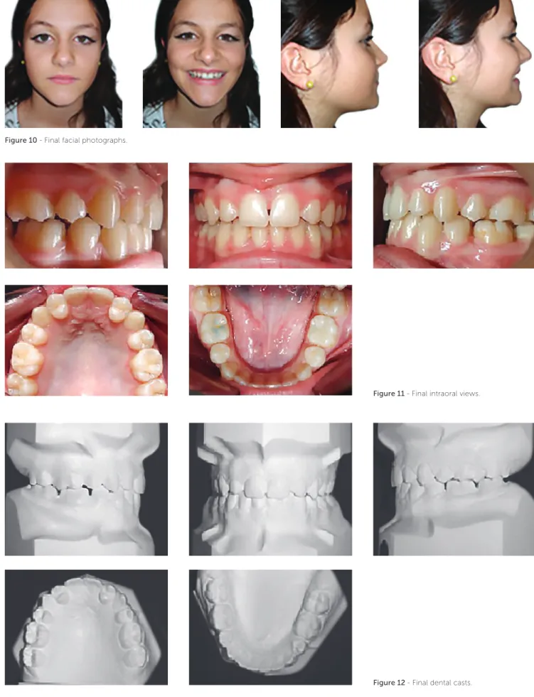Figure 10 - Final facial photographs.