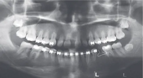 Figure 4 - Control panoramic radiograph.