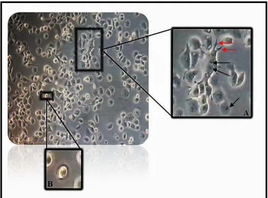 Figura 7. Avaliação das células THP-1, cultivadas no Laboratório de Malária do Instituto de Ciências Biológicas  da  UFMG,  em  microscópio  óptico  invertido,  após  72  horas  de  ativação  com  PMA