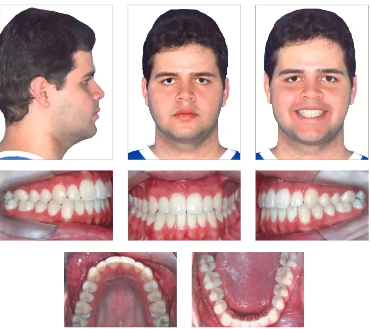 Figure 9 - Final facial and intraoral photographs.