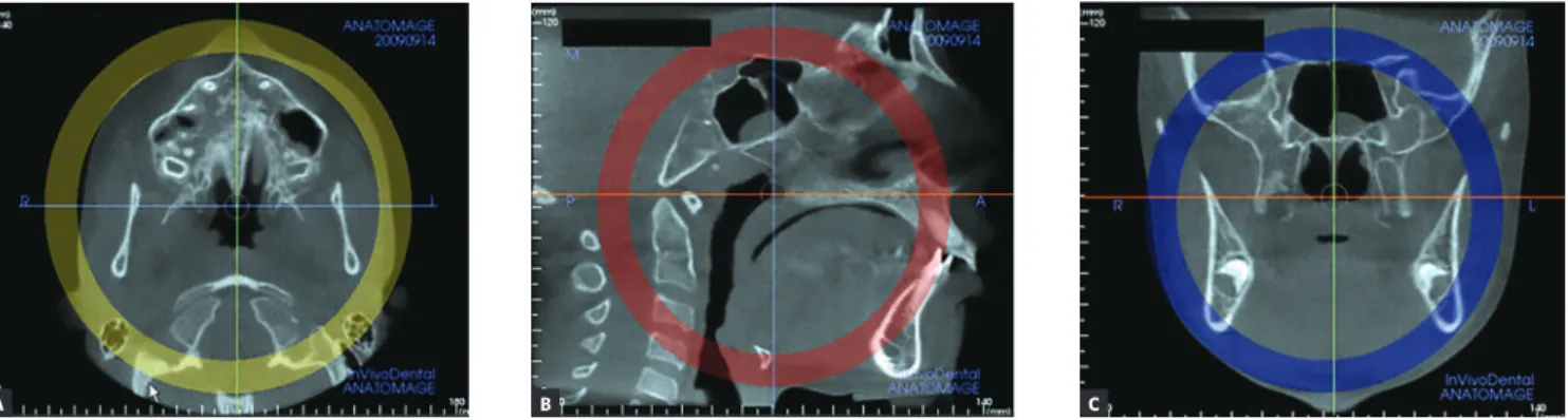 Figure 2 - Orientation of head position in the axial (A), sagittal (B) and coronal planes (C)
