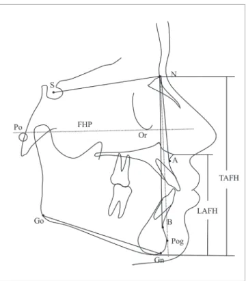 Figure 1 - ANB angle and Downs facial angle (angle formed between FHP and  NPog) were used to classify subjects into three skeletal classes