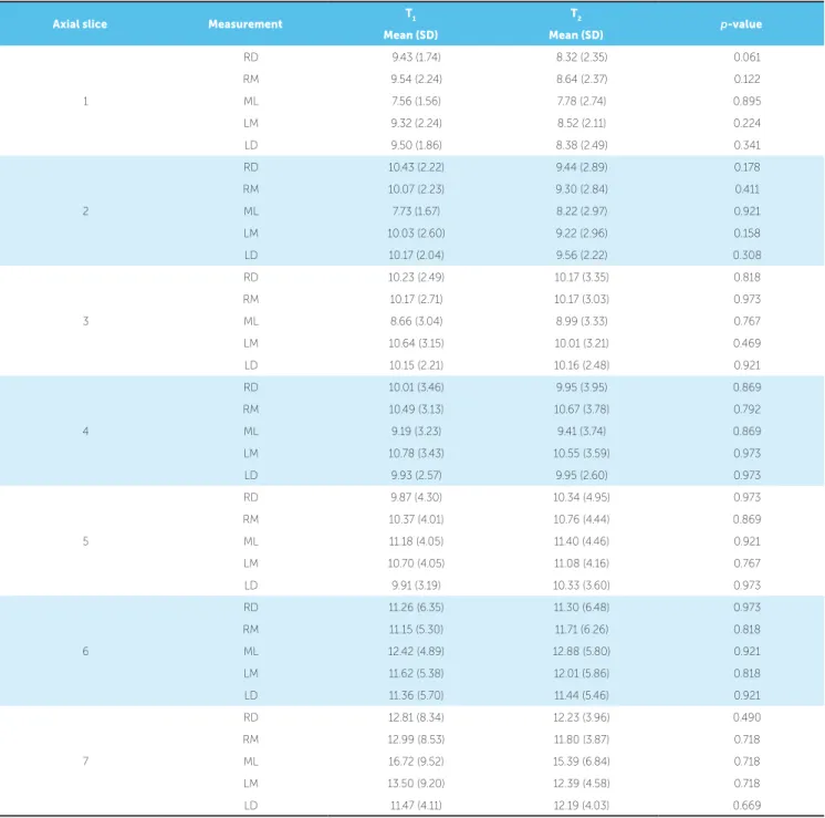 Table 2 - Descriptive analysis of alveolar bone thickness of the maxilla (mm) and p-value of Wilcoxon test.