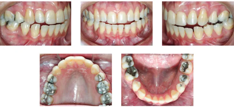 Figure 15 - Photographs of clinical conditions at the beginning of treatment.