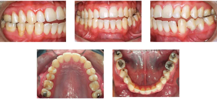 Figure 11 - Photographs of clinical conditions at the beginning of treatment.