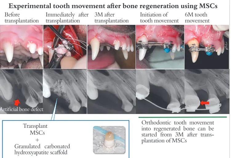 Figure 1 -Experimental tooth movement after bone regeneration using MSCs (Source: Tanimoto et al, 1  2015).