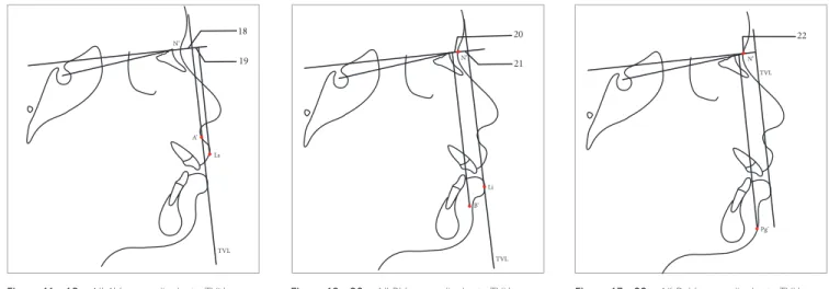 Figure 13 - 22 = N’-Pg’ (perpendicular to TVL).