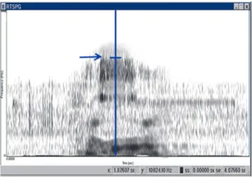 Figure 3 - Spectrogram of the Arabic word “Hassan”; the arrow indicates the  upper boundary frequency (UBF) of the /s/ sound.