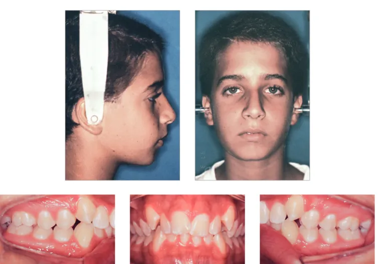 Figure 1 - Baseline facial and intraoral photographs.