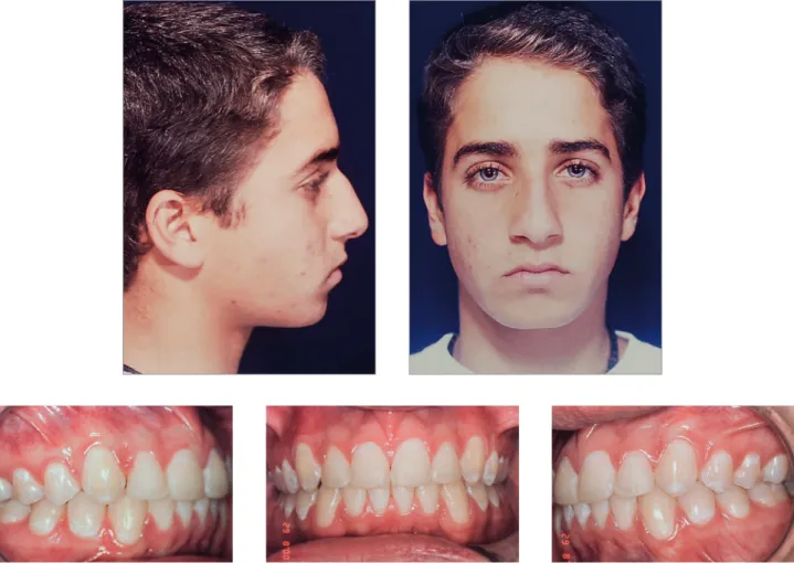 Figure 16 - Final facial and intraoral photographs.