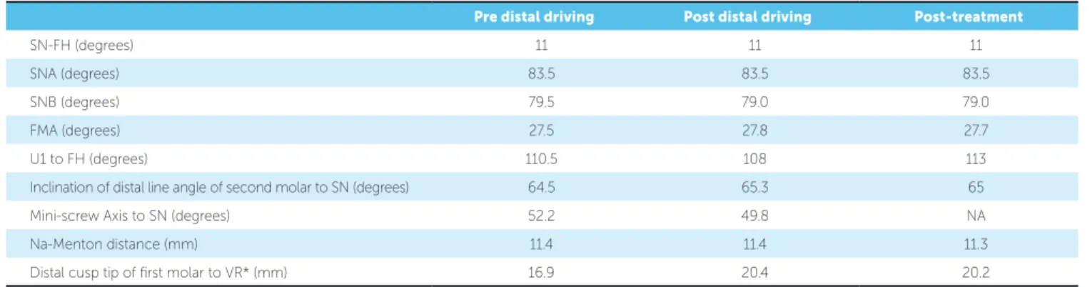 Table 1 - Cephalometric comparisons before and after distal driving and post-treatment.