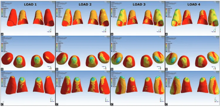 Figure 2 - Position of the odd numbered nodes in the LAP referential plane to right maxillary central incisor (A - labial view; B - apical view; C - palatal view)  and to right maxillary lateral incisor (D - labial view; E - apical view; F - palatal view).