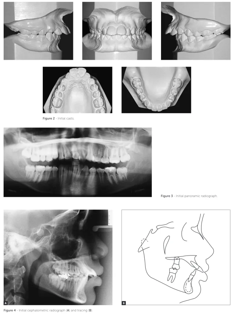 Figure 3 - Initial panoramic radiograph.