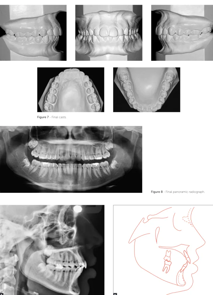 Figure 8 - Final panoramic radiograph.