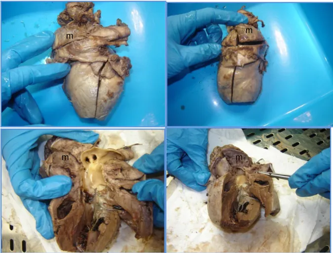 Figura 3: Fotografias do coração do Kiki, recolhido após a necrópsia, evidenciando a massa (m) na base da aorta