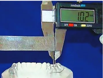 Figure 2  - A) Modified digital caliper. B) Closer view of the main part of the  modified caliper.