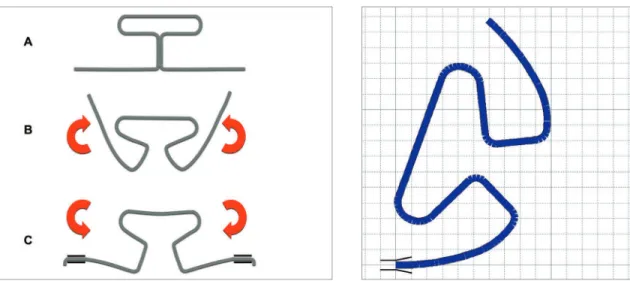 Figure 1 - A) TLS in passive form. B) TLS preactivated by gradual curva- curva-ture. C) TLS engaged to brackets (loaded in an opposite direction to the  preactivation).