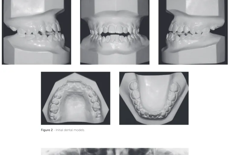 Figure 3 - Initial panoramic radiograph.