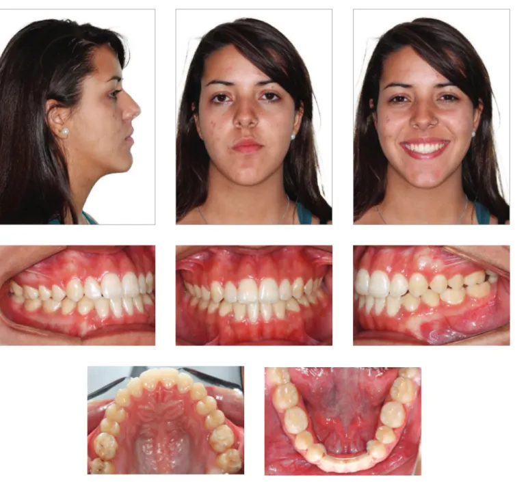 Figure 10 - Final extra- and intraoral photographs.