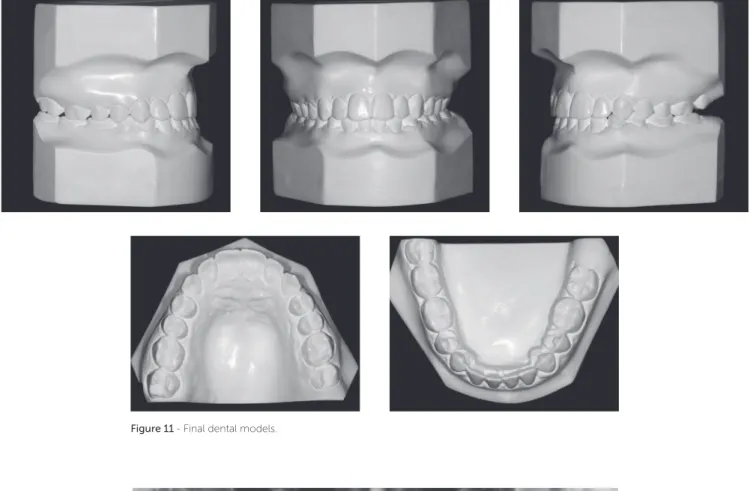 Figure 12 - Final panoramic radiograph.