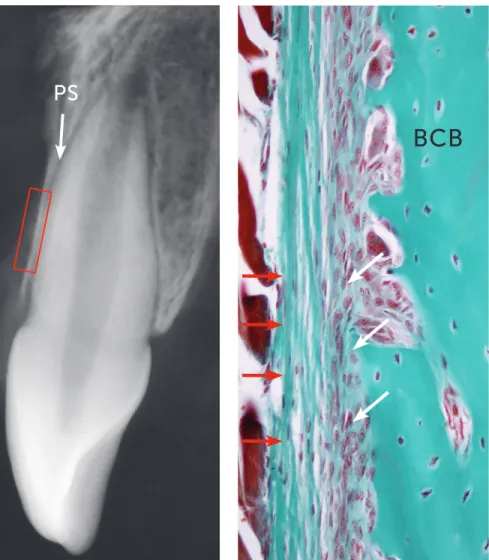 Figure 2 - Periosteum formed by external fi- fi-brous layer (red arrows) and internal cellular  lay-er (white arrows) directly associated with  buc-cal cortibuc-cal bone plate (BCB)