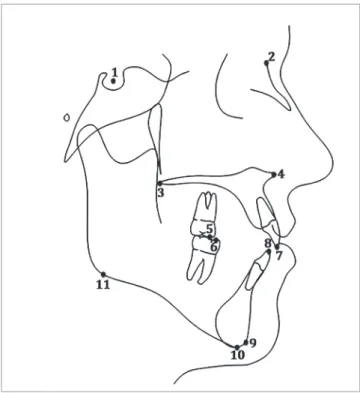Figure 1 - Anatomical landmarks: 1) Sella; 2) Nasion; 3) Posterior nasal spine; 