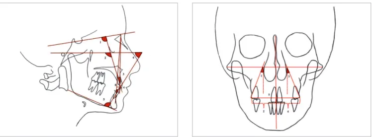Figure 1 - Lateral cephalometric dental angular and linear measurements: 