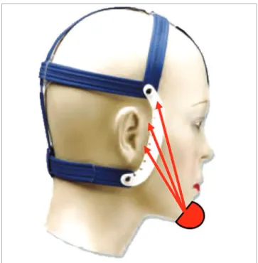 Figure 1  - Chincup therapy with Interlandi’s cap in different directions of load  application.