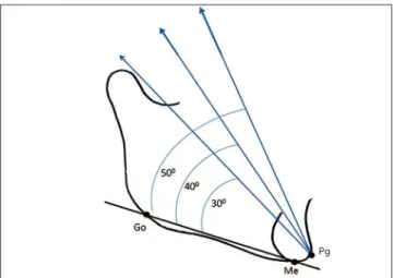 Figure 4  - Discretized TMJ disc model.