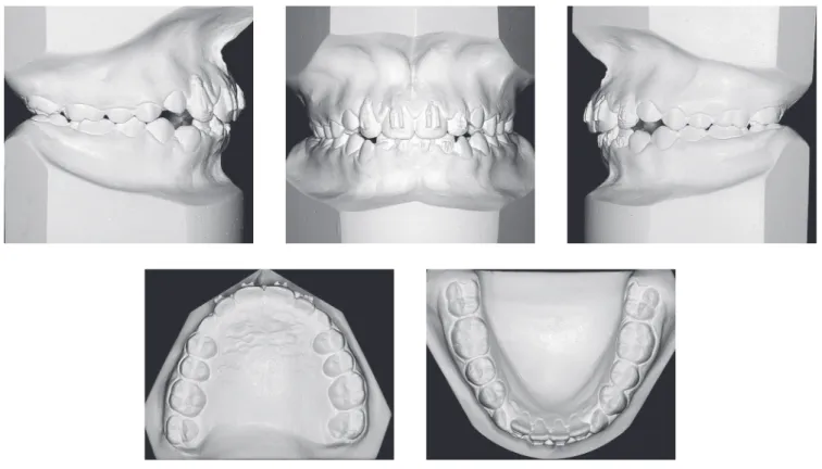 Figure 8 - Intermediate panoramic radiograph.